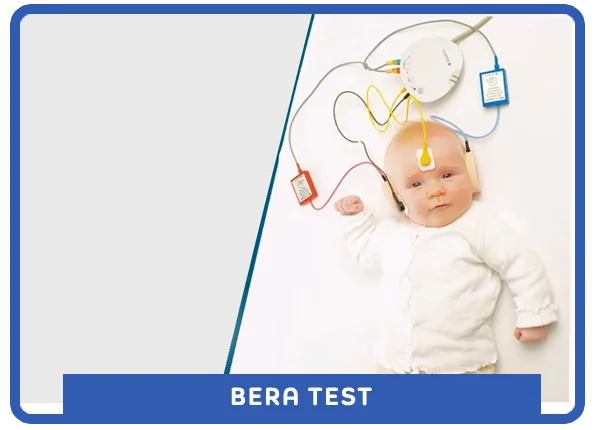 BERA Test